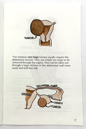 After Hysterectomy WHAT?